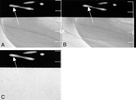 fig 2.