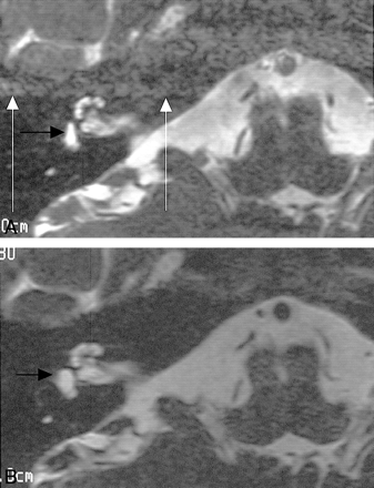 fig 4.