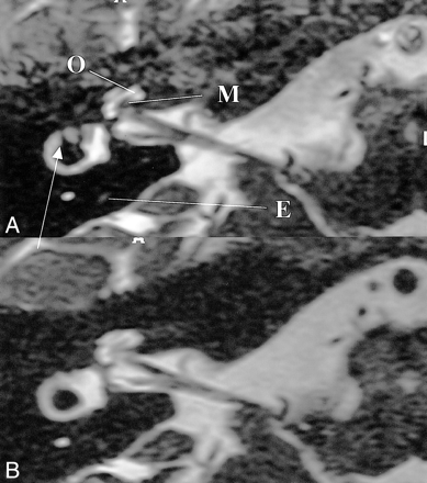 fig 5.