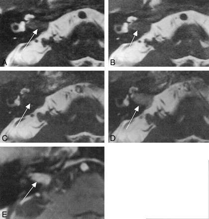 fig 8.