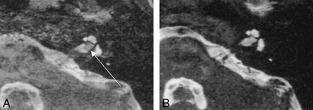 fig 9.
