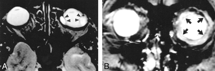 fig 3.