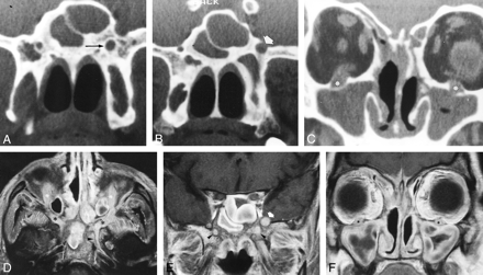 fig 1.