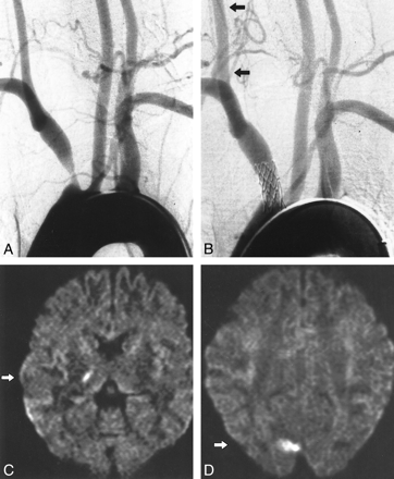 fig 2.