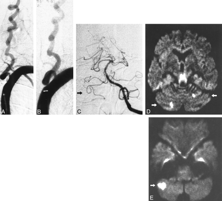 fig 3.