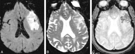 fig 2.
