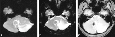 fig 3.