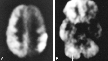 fig 5.