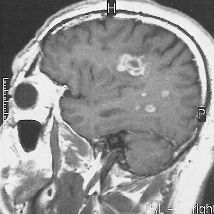 fig 4.