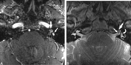 fig 6.