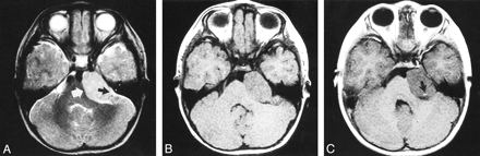 fig 1.