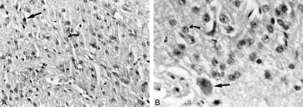 fig 2.