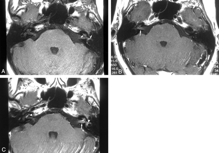 fig 1.