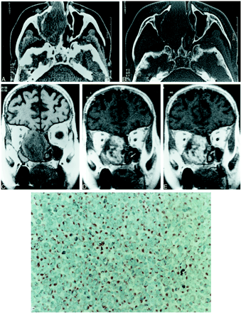 fig 1.
