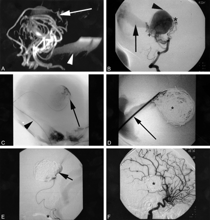 fig 2.