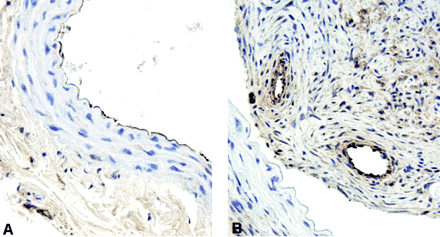 fig 4.