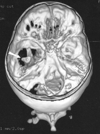 fig 1.