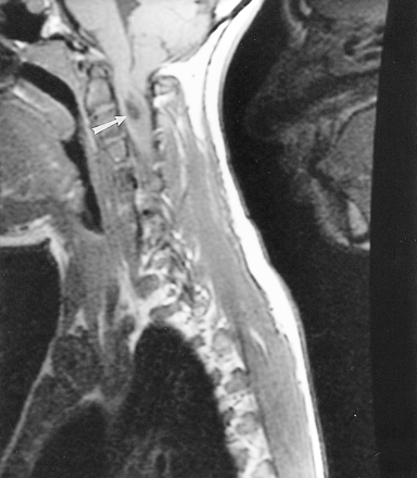 fig 3.