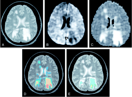 fig 2.