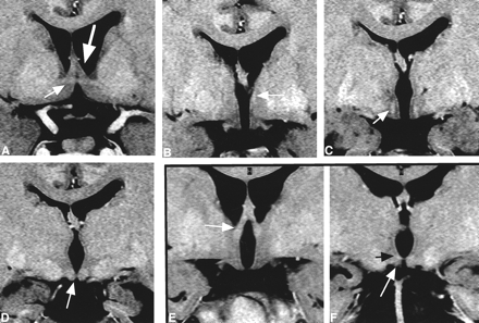 fig 3.