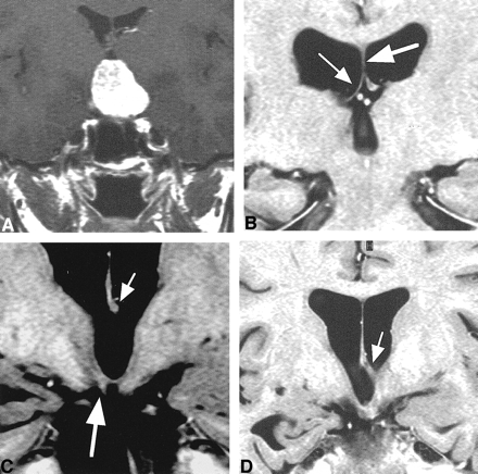 fig 6.