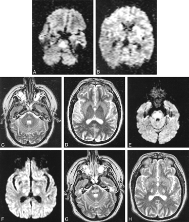 fig 1.