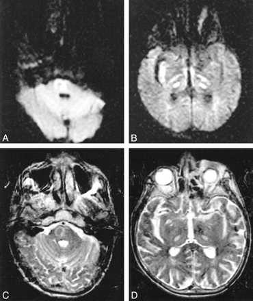 fig 2.