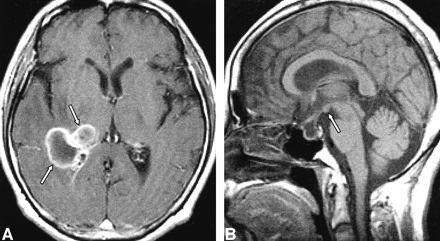 fig 1.