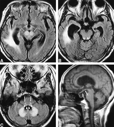 fig 2.