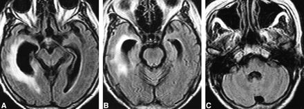 fig 3.