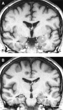fig 5.