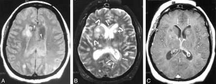 fig 2.