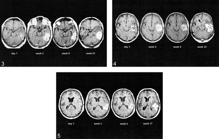 fig 3.