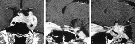 fig 2.