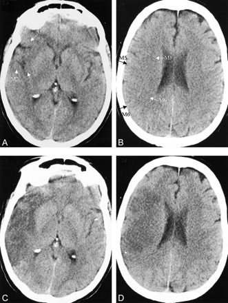fig 2.