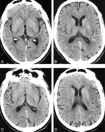 fig 3.