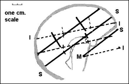 fig 5.
