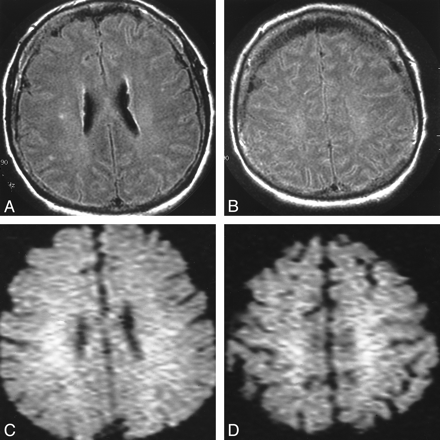 fig 2.