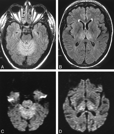 fig 3.