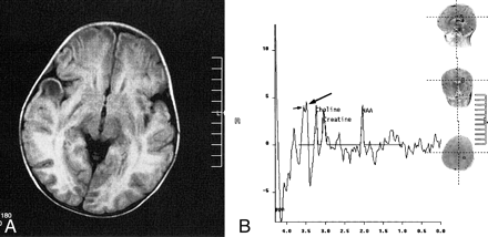 fig 2.