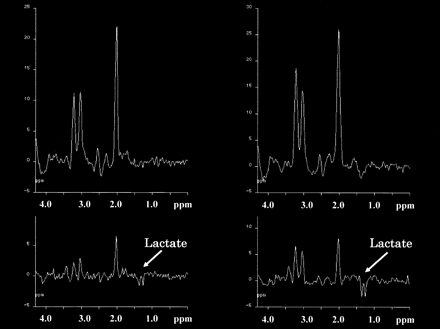 fig 2.