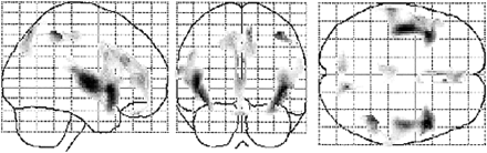 fig 2.
