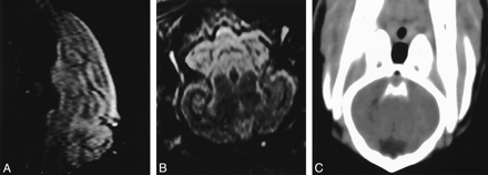 fig 1.