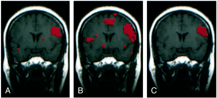 fig 4.