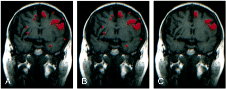 fig 6.