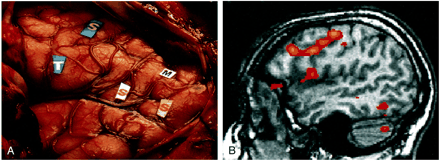 fig 7.