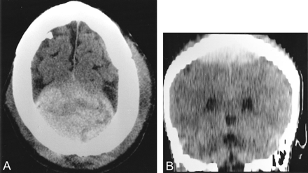 fig 1.