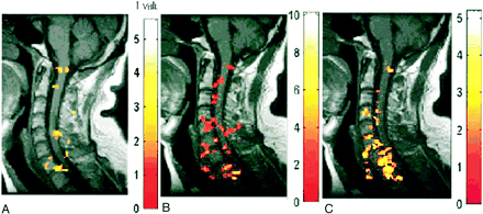 fig 2.
