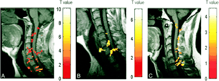 fig 3.