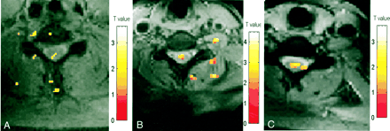 fig 5.